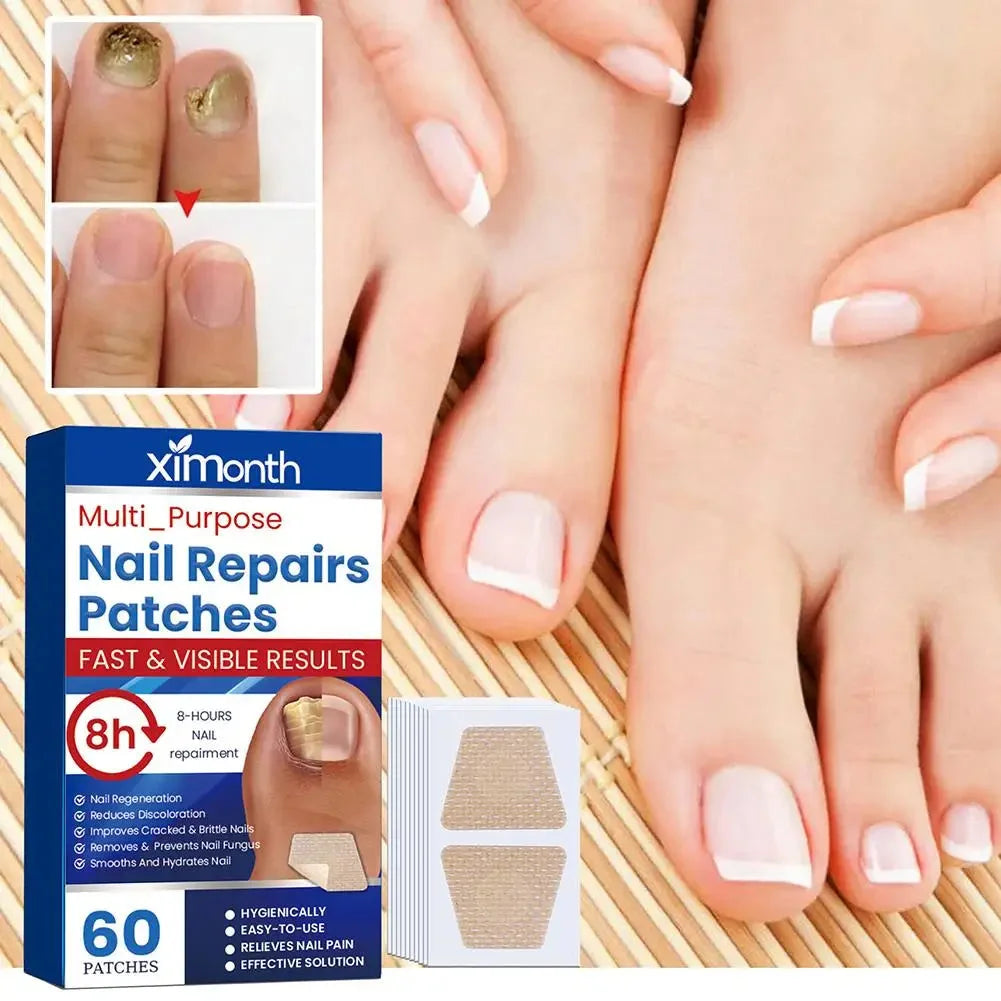 Discrete Herstelpleisters voor Schimmelnagels — foto 2