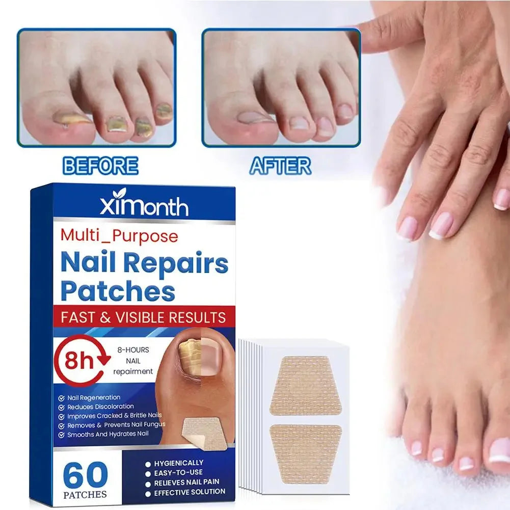 Discrete Herstelpleisters voor Schimmelnagels — foto 3
